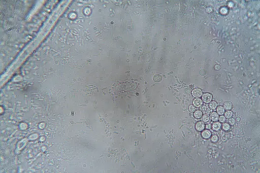 Blogbild Die Bedeutung des Mikrobioms für unsere Gesundheit des Users office@balancio.at